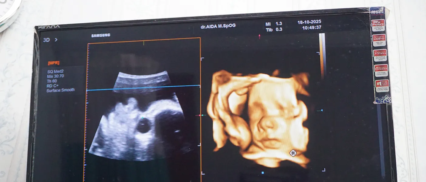 USG dengan Teknologi Canggih